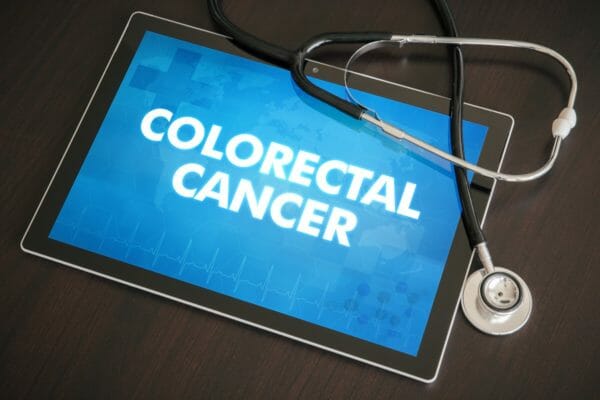 Colorectal cancer rate rise among young adults