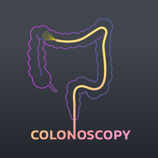Illustration of colonoscopy for patients of all ages, not just 45