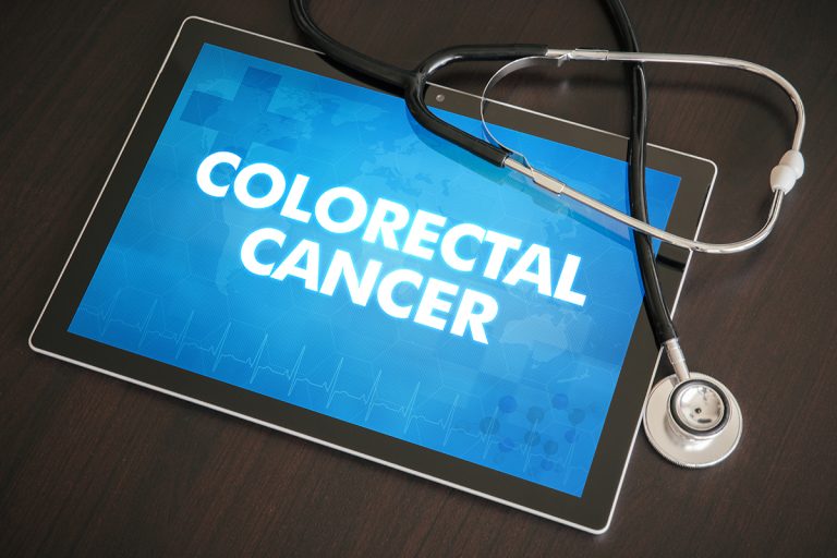 how-long-does-colorectal-cancer-surgery-take-what-to-expect-afterward